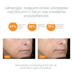 Biolumin-C Serum - 30 ml.