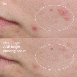 AGE Bright Clearing Serum 30ml