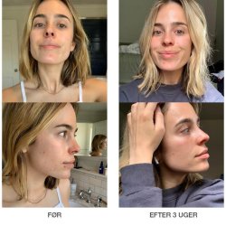 Retinol Clearing Oil - 10 ml.