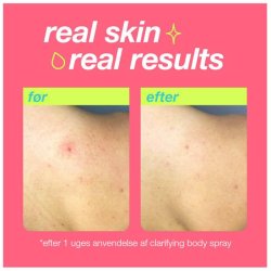 Clarifying Body Spray - 177 ml.