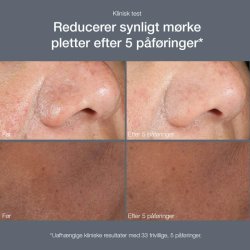 Powerbright Dark Spot Peel 50ml