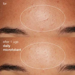 Daily Microfoliant 74 g.