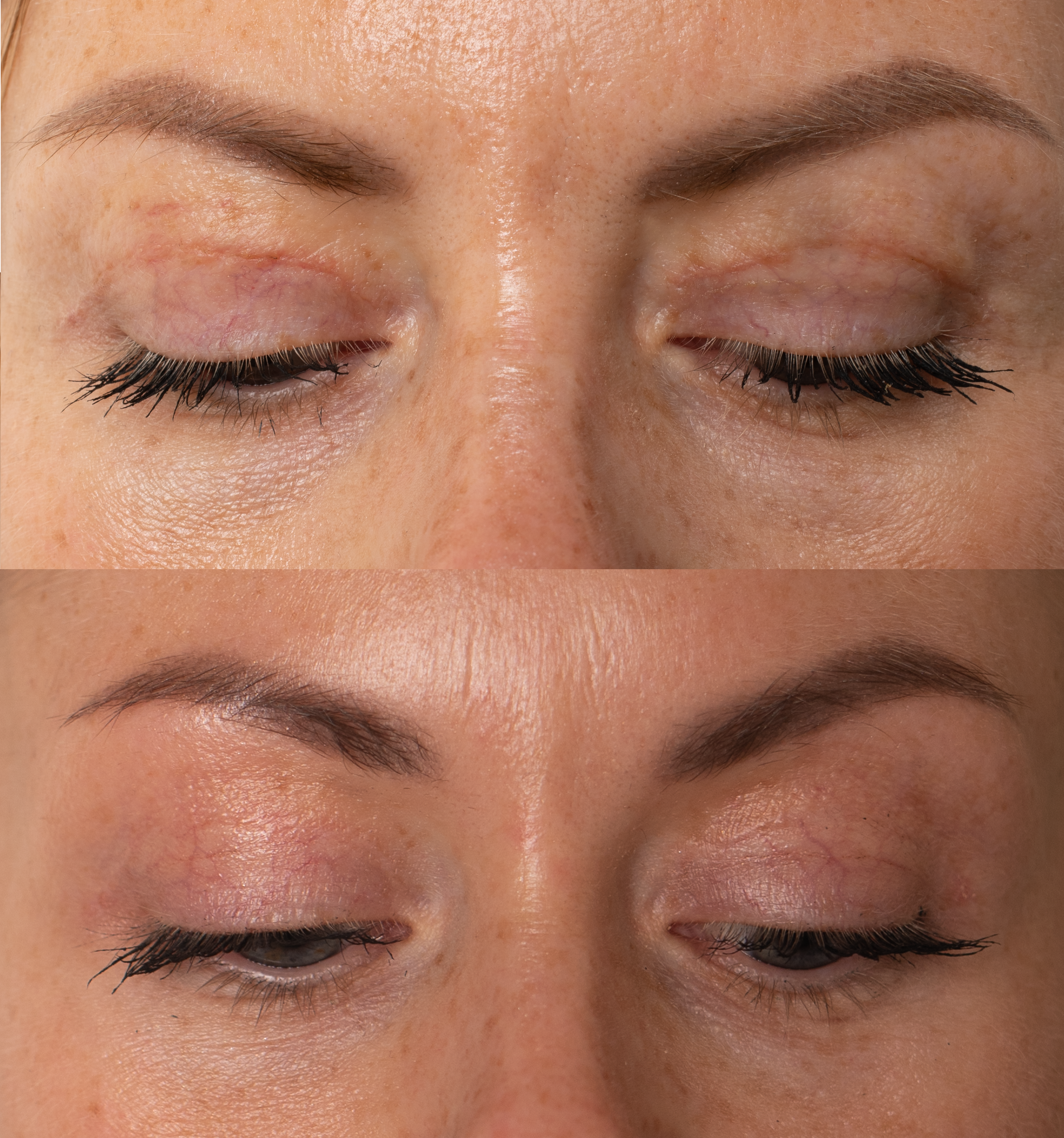 Skin Repair Active Regenerating Serum
