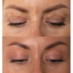 Skin Repair Active Regenerating Serum