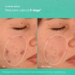 Breakout Biotic Moisturizer 50 ml.